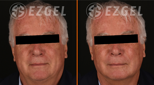 EZgel1.png