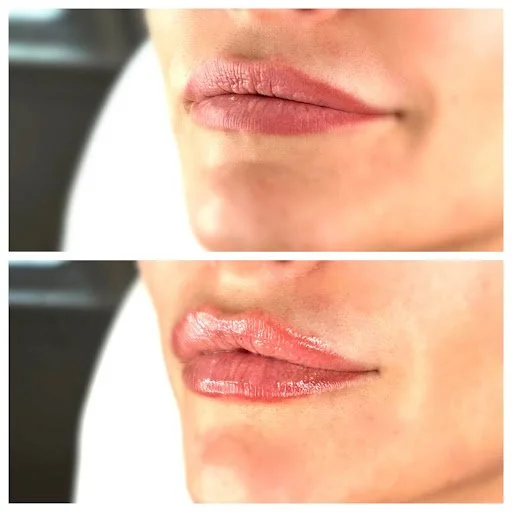 HA lips 1.jpg
