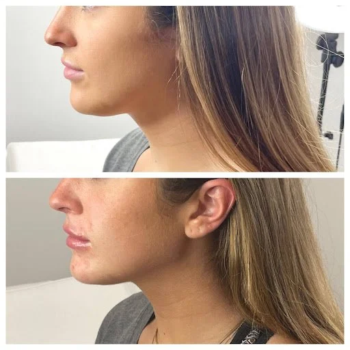 HA jaw 2.jpg