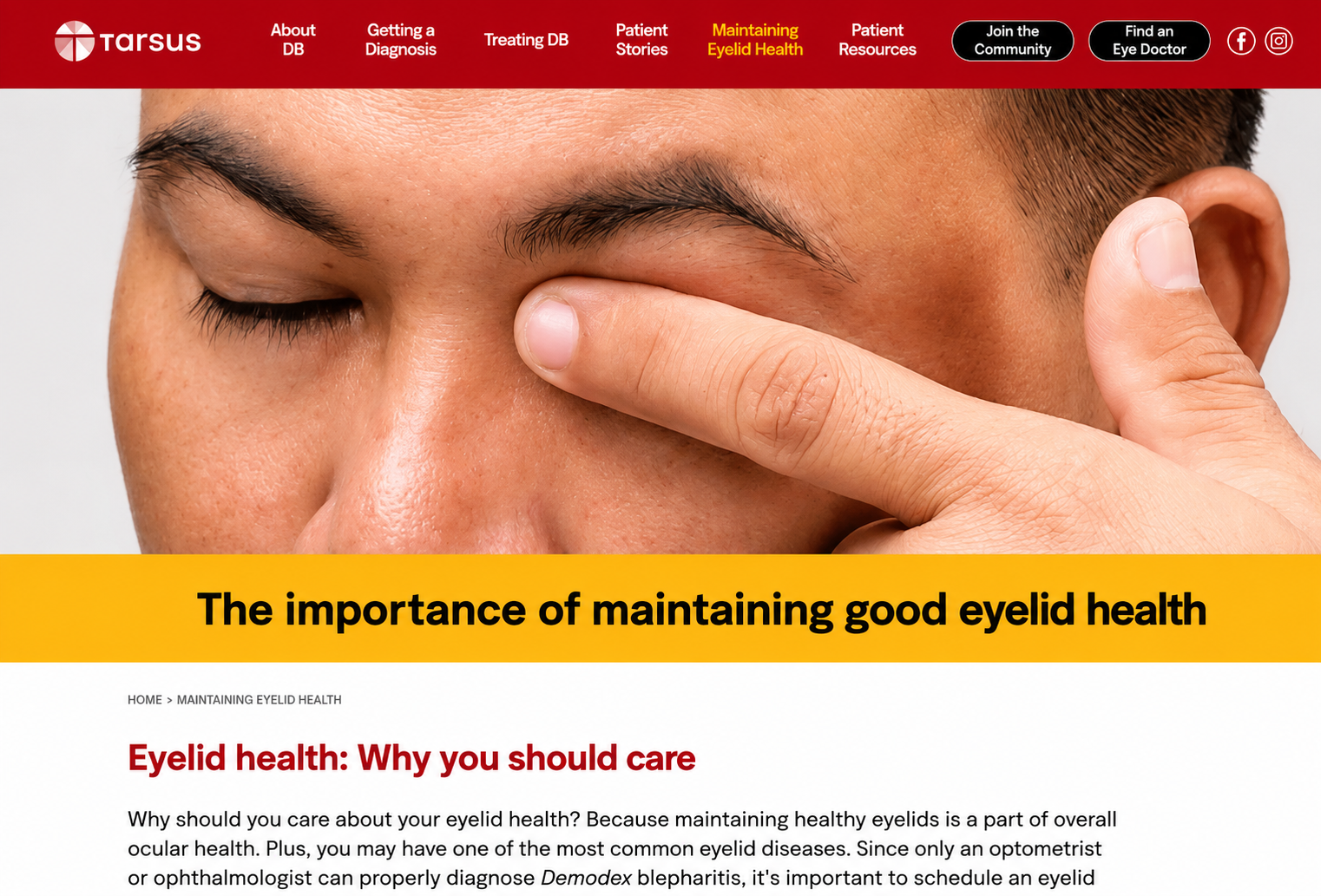 eyelid-check-website-06.PNG