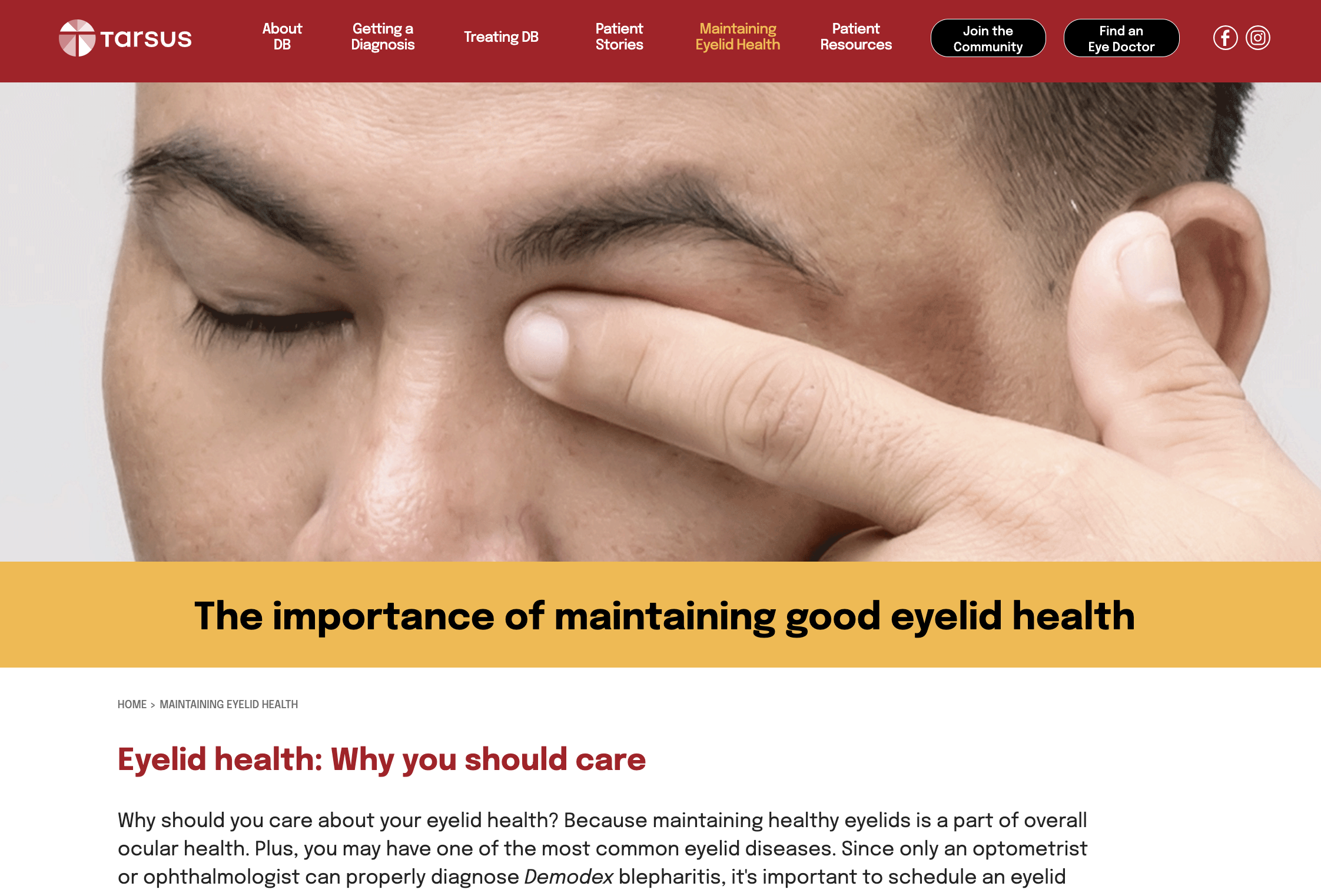 eyelidchk-06.png