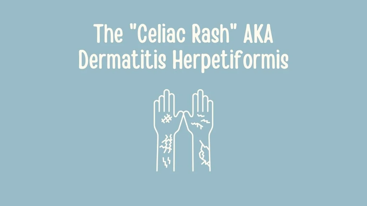 The _Celiac Rash_ AKA Dermatitis Herpetiformis.jpg