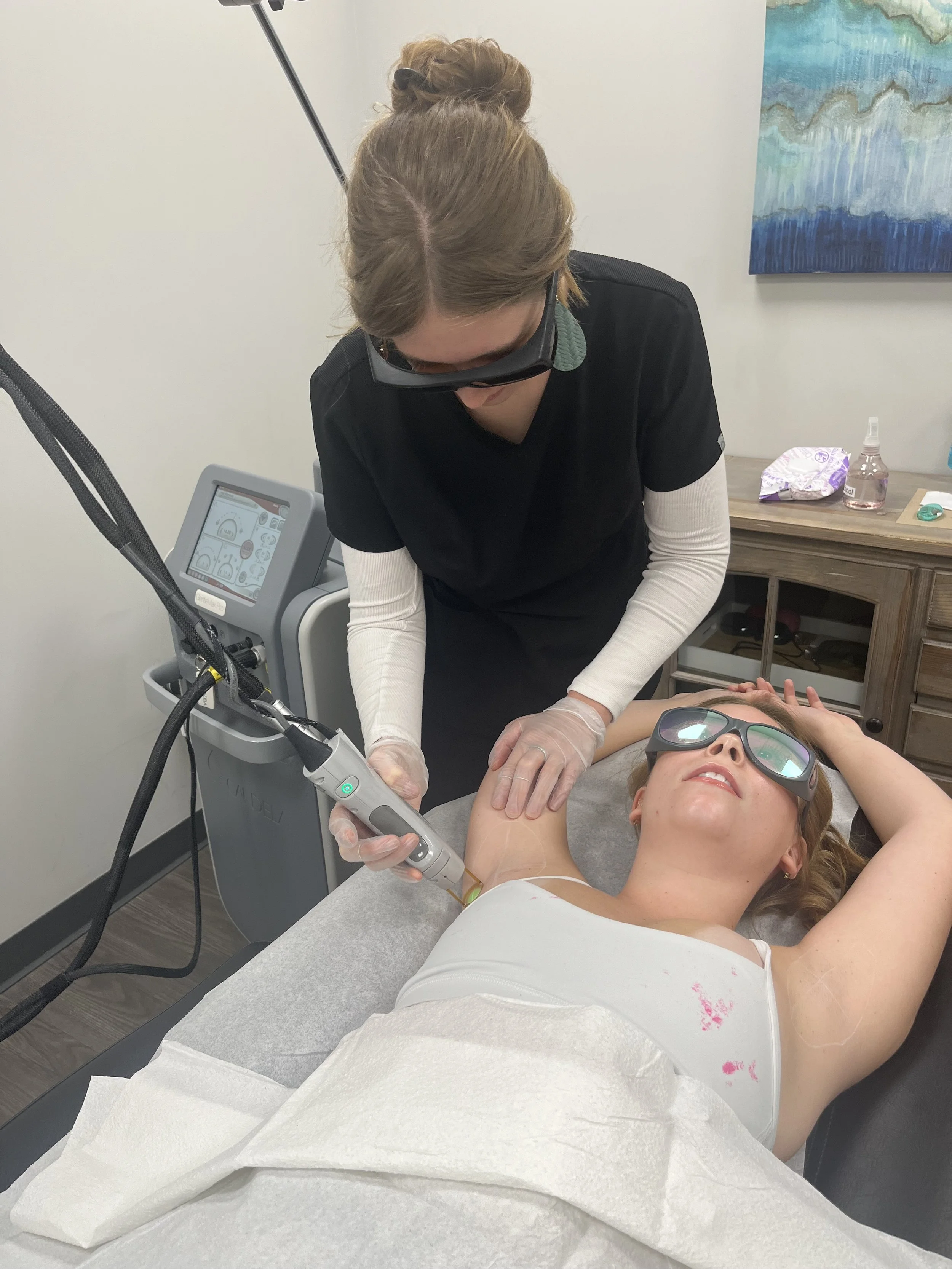 laser tech wearing black scrubs preforming laser hair removal on an armpit