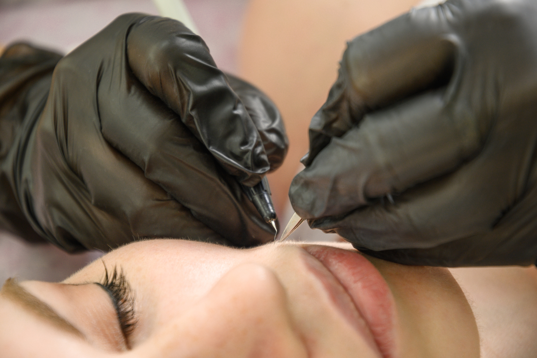 electrolysis treatment being preformed on a chin