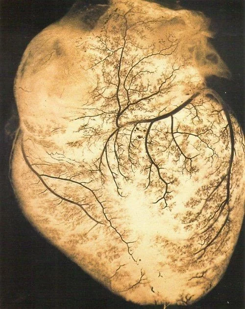 Radiant Heart Meditation