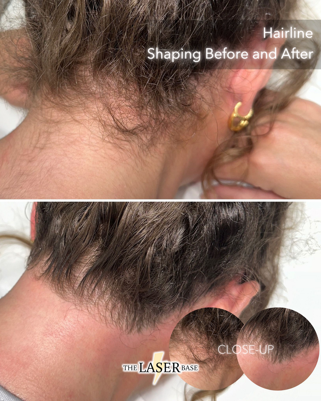 BEFORE  2 copy 2.png.PNG