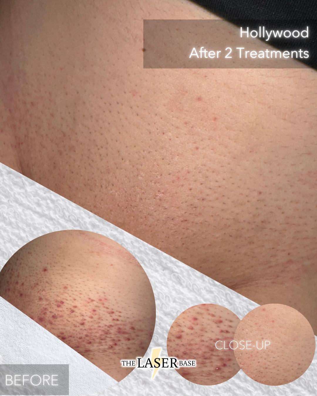 BEFORE .zip - 1 (1).PNG