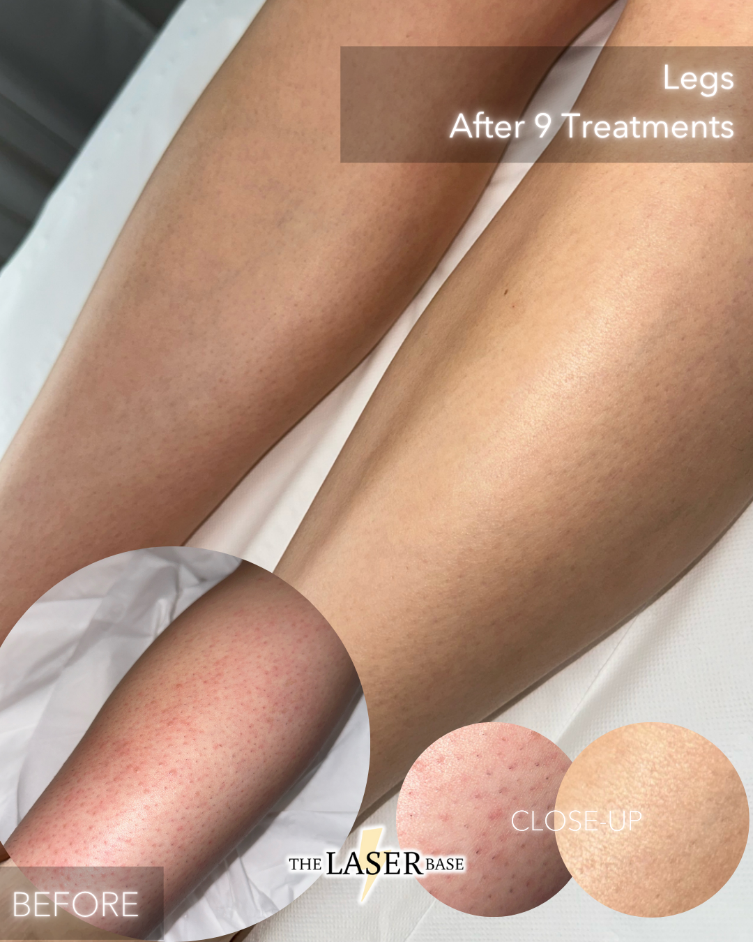 BEFORE & AFTERS.png.PNG