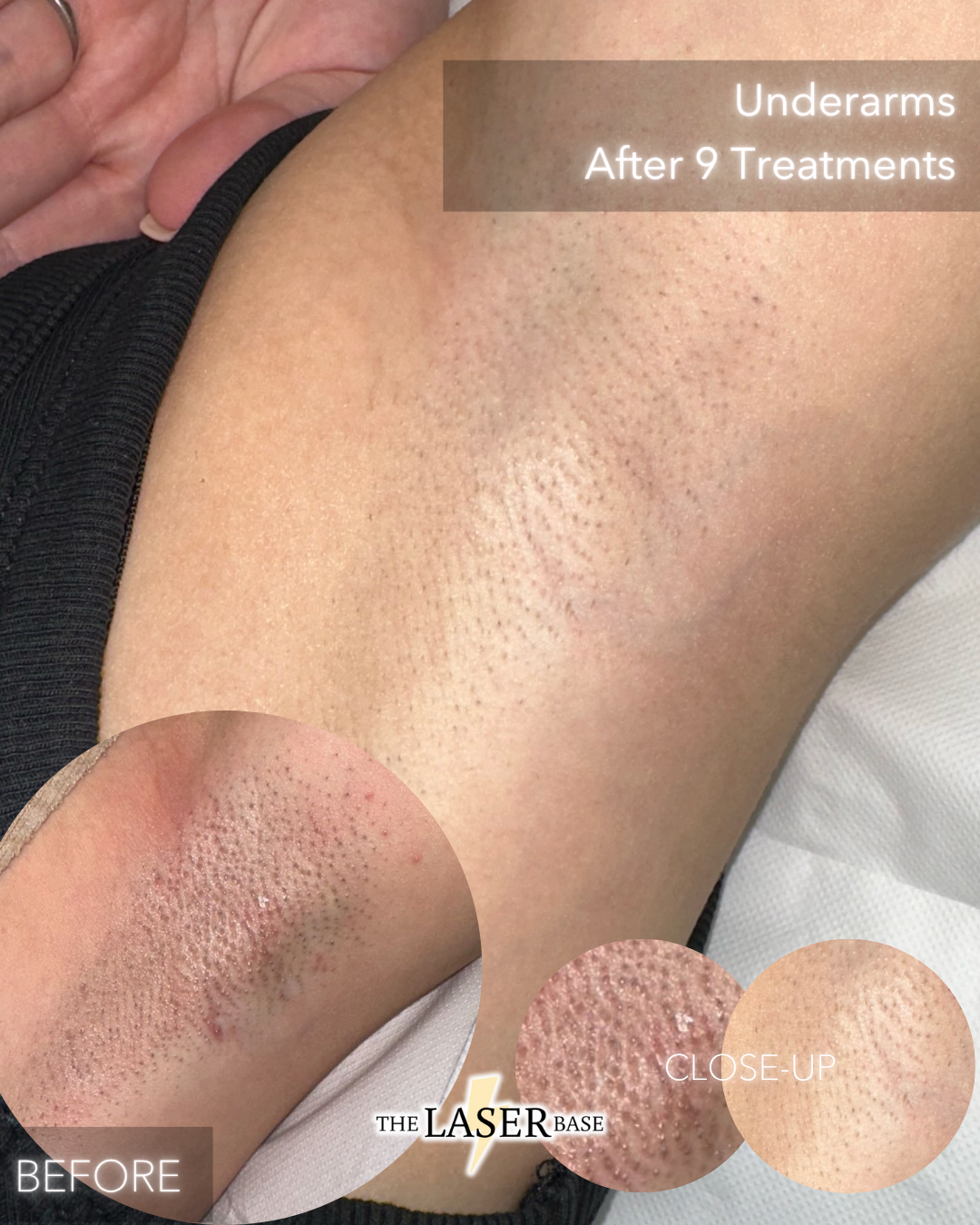 BEFORE & AFTERS.zip - 1.PNG