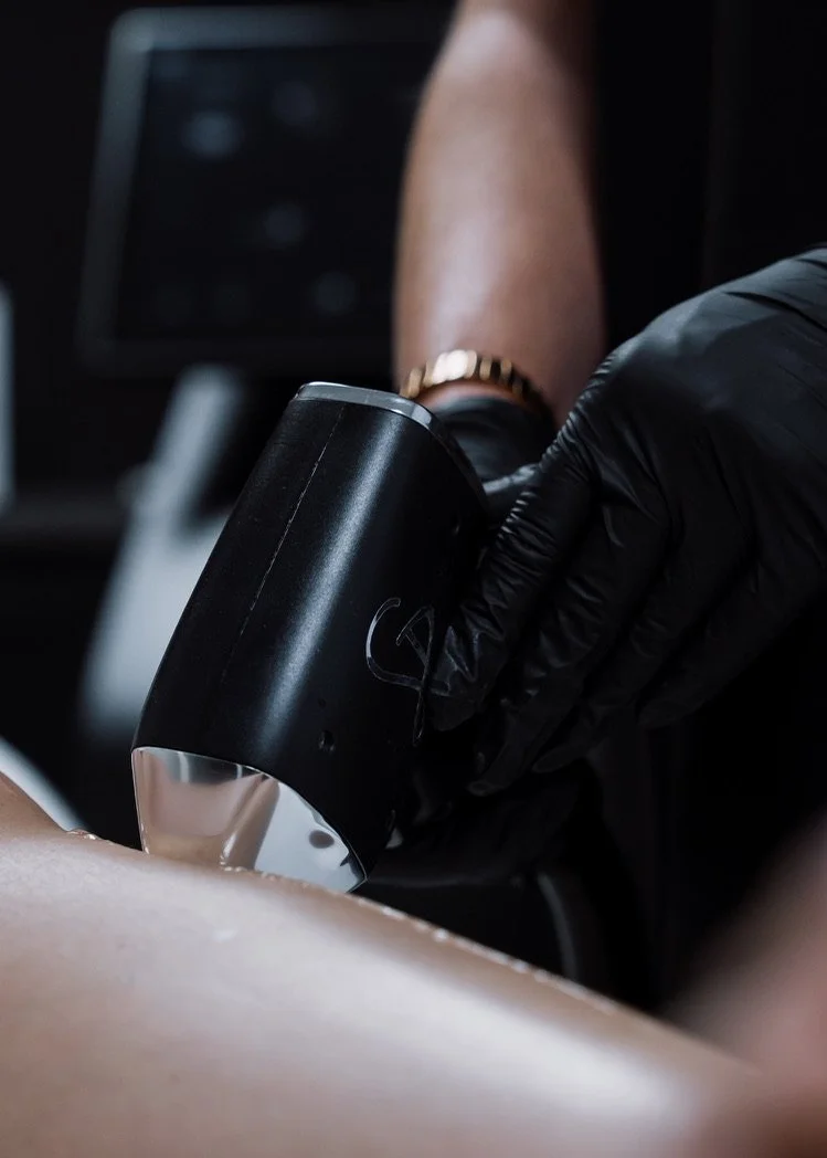 Why Laser Hair Removal Results Plateau (And How to Fix It)