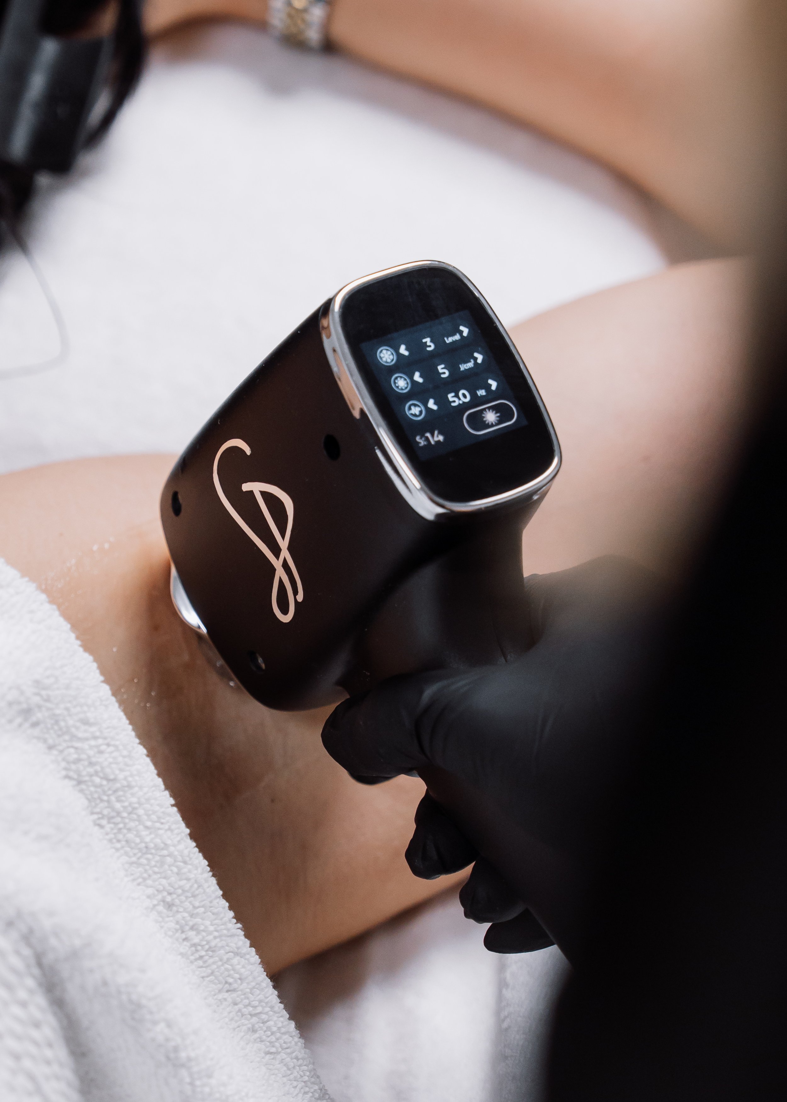 Laser vs Wax: The 2026 Cost Break-Even Might Surprise You