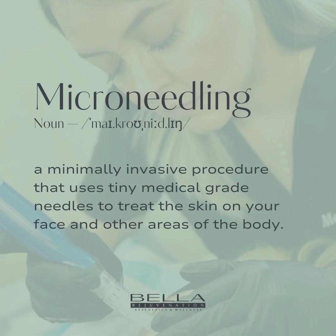 ✨ Microneedling is perfect for your face, but works wonders on other areas of the body.

This treatment stimulates collagen and elastin production, helping to:

✔️ Fade the appearance of scars
✔️ Soften wrinkles
✔️ Reduce stretch marks
✔️ Lighten dar