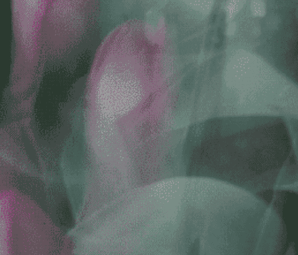 Soft-focus photograph of pink and mauve tulips against deep green, their forms barely discernible — evoking something beautiful not yet fully revealed.