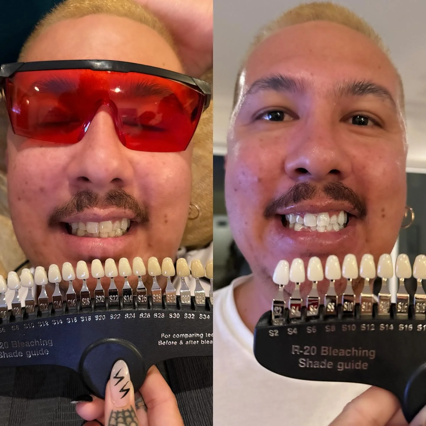 glow baby glow ✨ book your whitening sesh - link in bio

#lovebite #teethwhitening #mobile #slo 
#sloteethwhitening #slolovebite