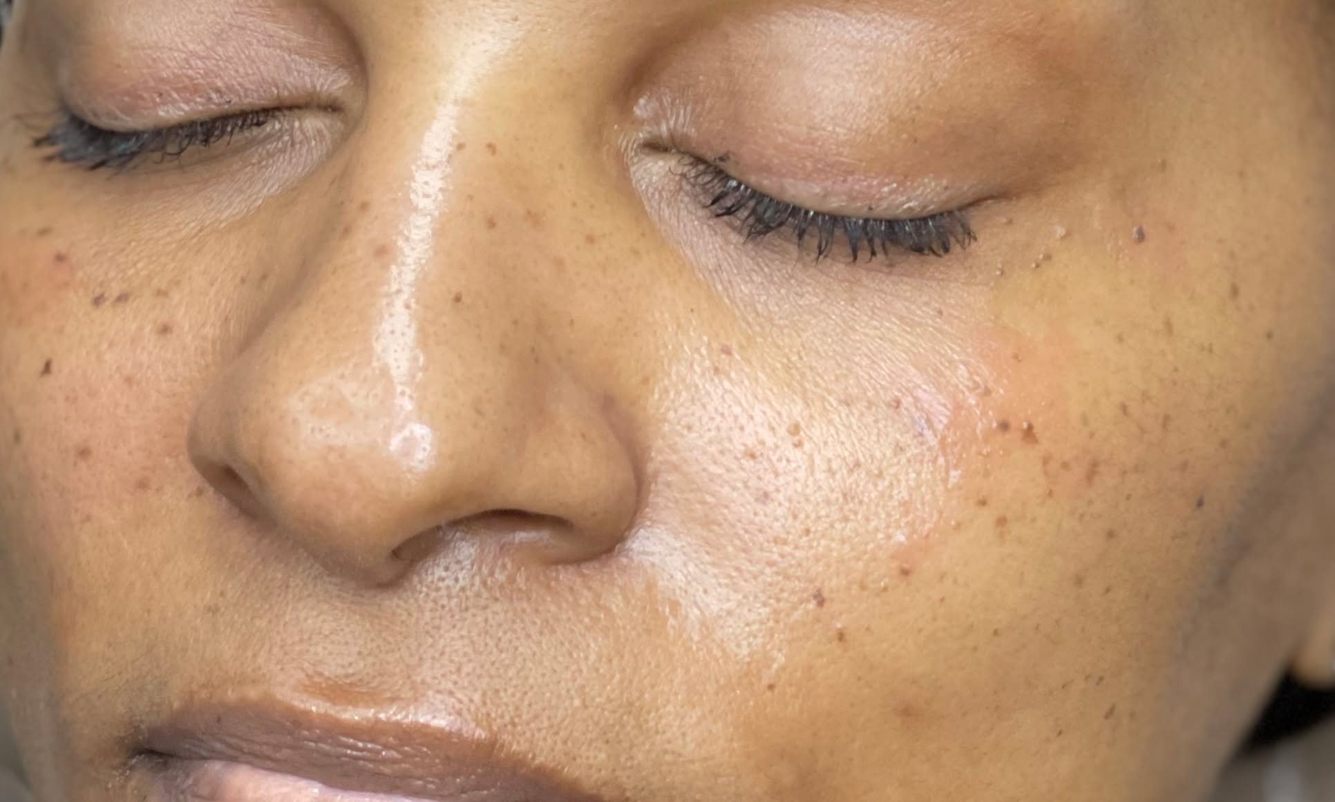 Close-up of cosmetic faux freckles and beauty marks.