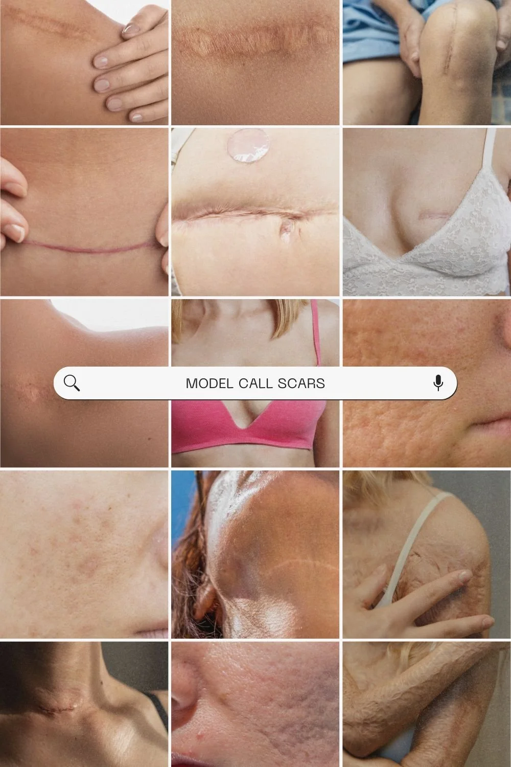 Type of Scars
