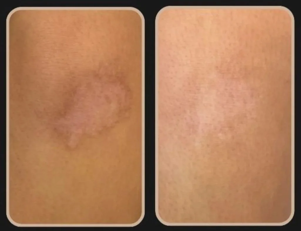 Dark Scar 