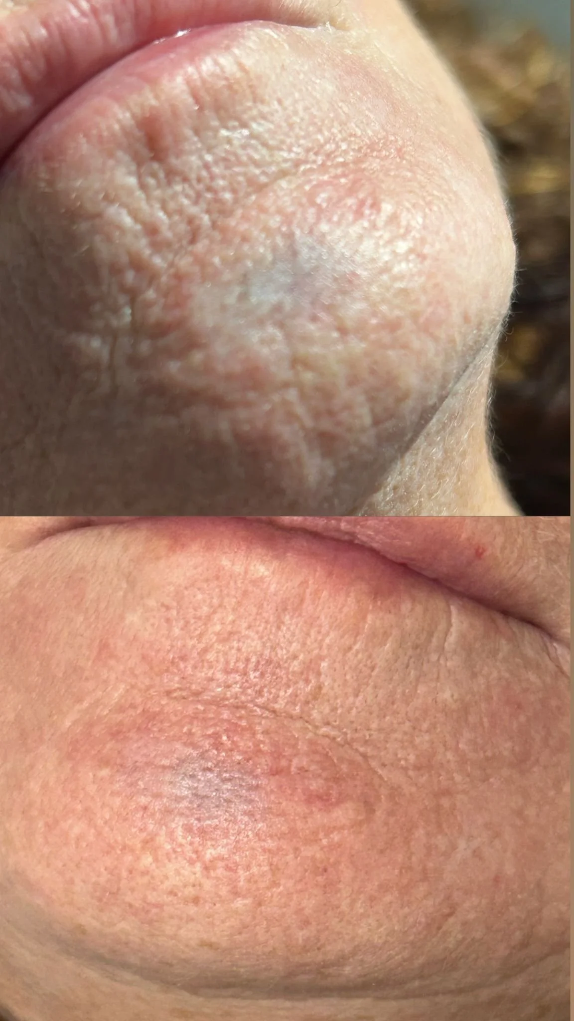 Close-up of a person's nose showing dry, flaky skin in the top image and smooth, hydrated skin in the bottom image.