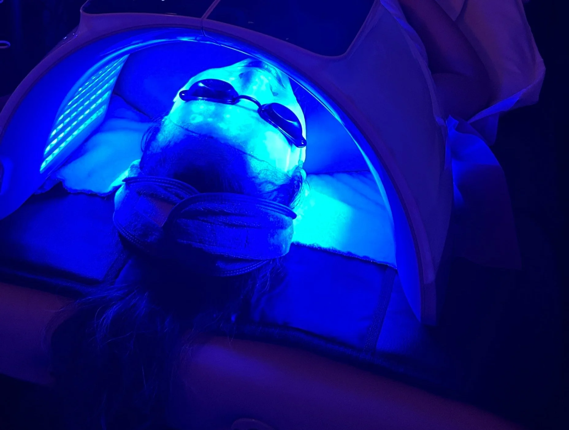 Person undergoing a blue light therapy treatment while lying on a bed with an eye mask, with their head inside a specialized light chamber.