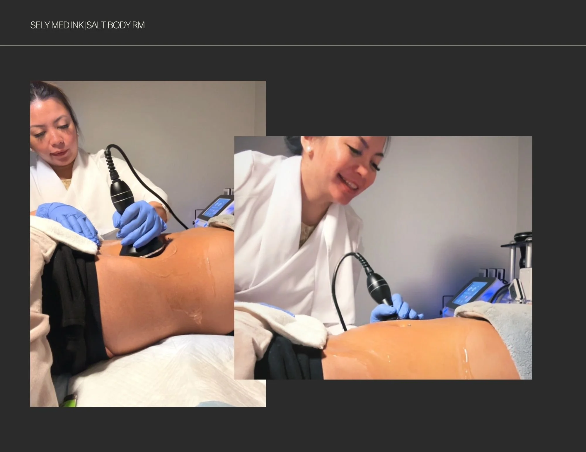 Non Invasive Body Sculpting | Contouring