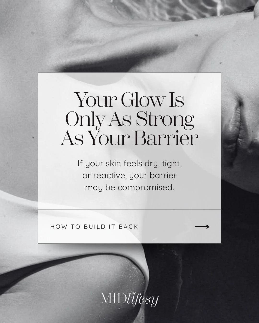 Your skin barrier is your first line of defense&mdash;and when it&rsquo;s compromised, your selfie takes a hit. 📸✨

Think of it like the roof of your house:
🏠 Strong + intact &rarr; everything underneath stays protected, hydrated, and balanced.
🏚️