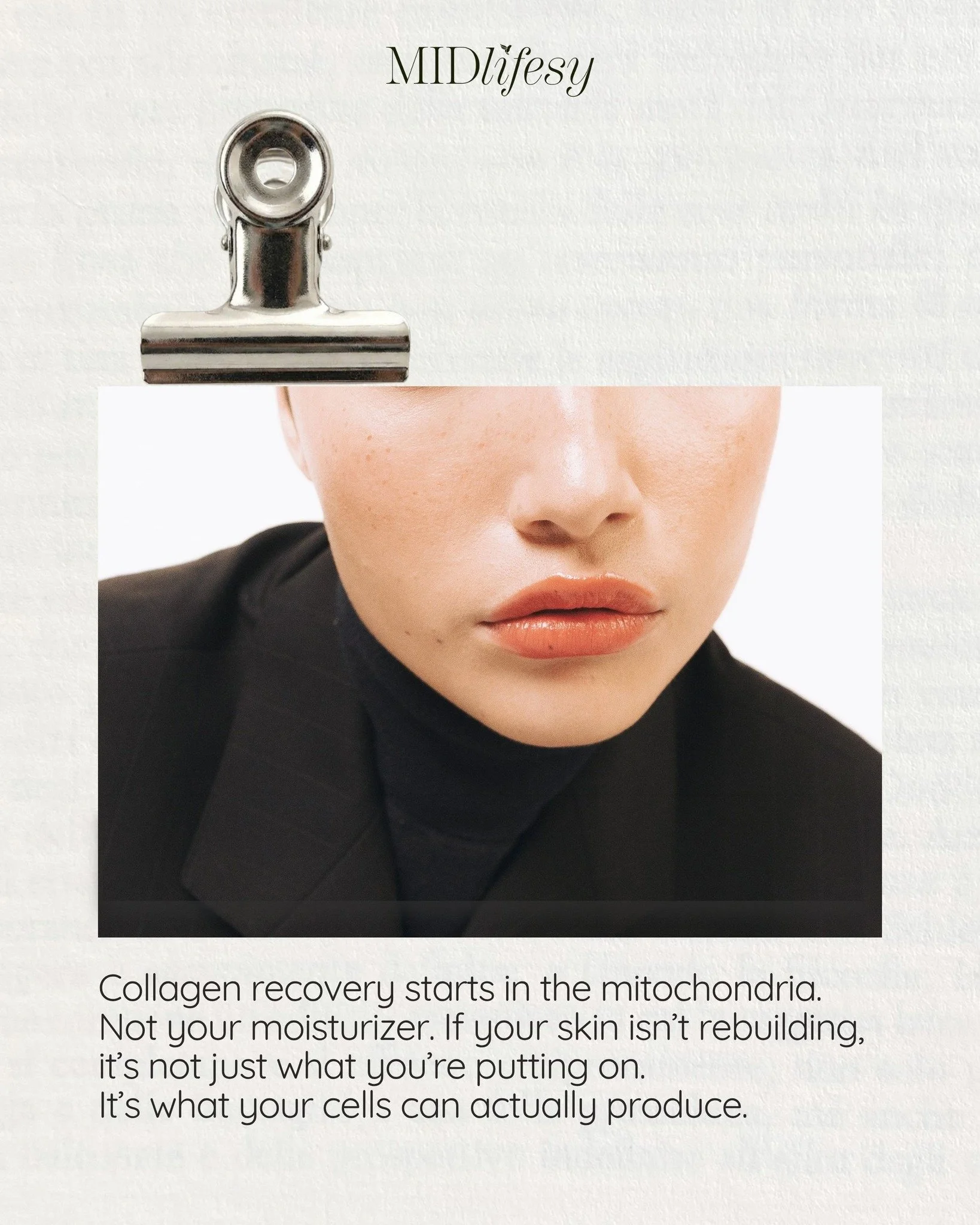 Most women assume collagen loss is a skincare problem.
But often, it&rsquo;s a cellular energy problem. ⚡

Your skin doesn&rsquo;t just need collagen products&mdash;it needs the capacity to make collagen.
And that starts with your mitochondria, the e