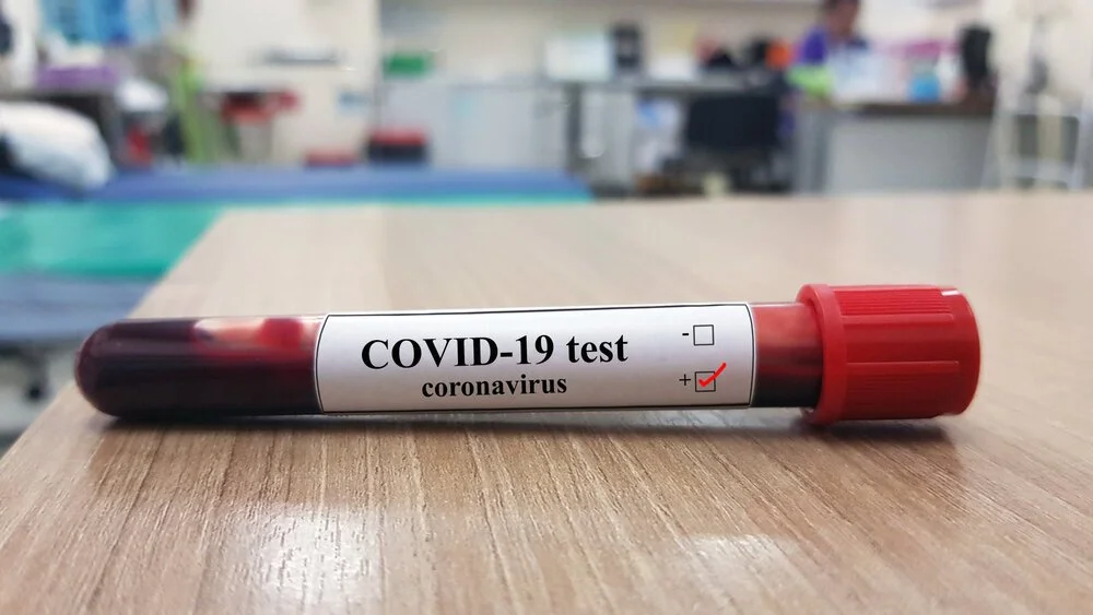 Does Workers’ Comp Cover Covid-19 Affected Employees?