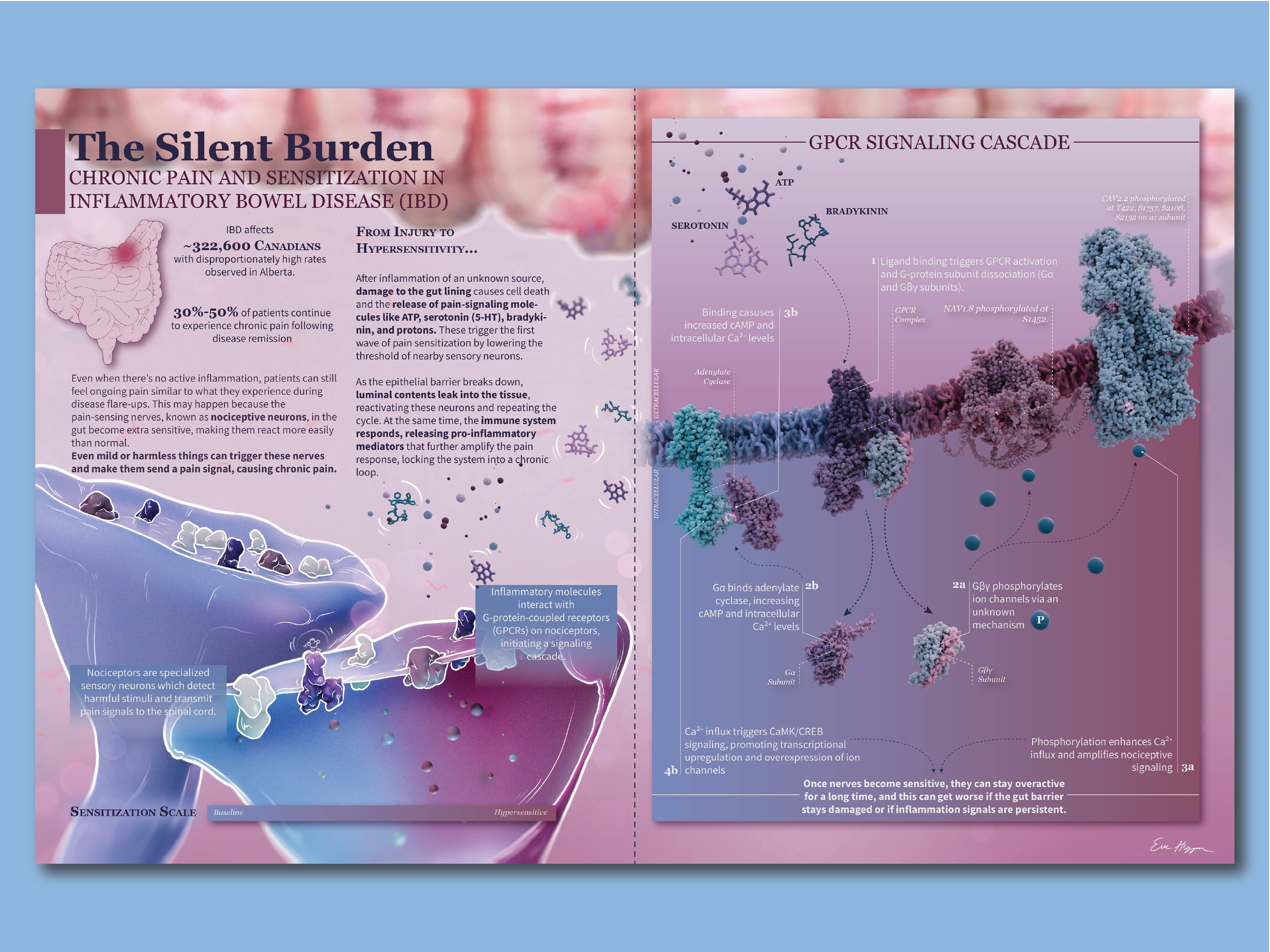 The Silent Burden -The GPCR signalling cascade and IBD