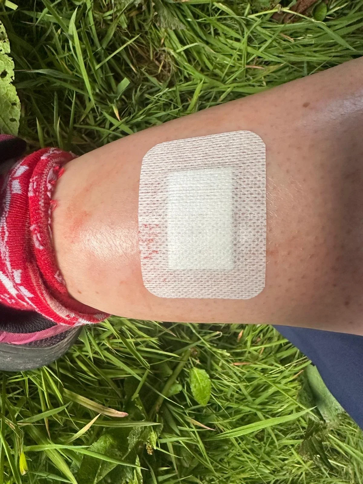SITW 2025 shin treatment.jpeg