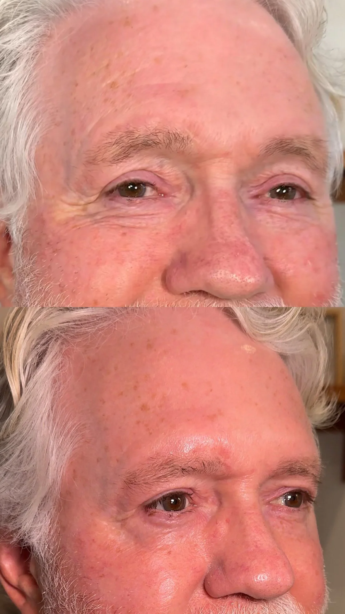 Before and after facial treatment results showing smoother skin texture and tone, Boon Aesthetic Wellness in Claremont, CA