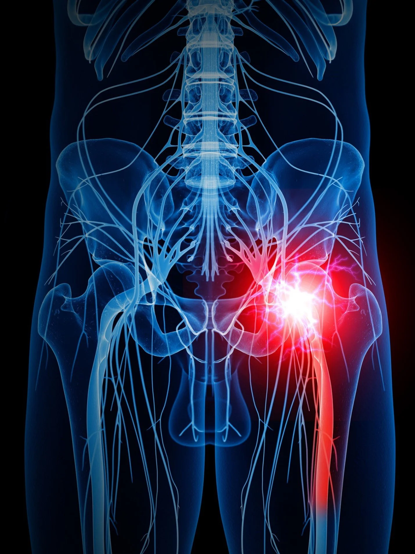 A medical illustration of the human pelvic area showing nerves and blood vessels, with a highlighted red area indicating pain or injury in the lower right side of the pelvis.