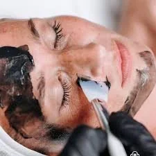 acne-facial-wentzville