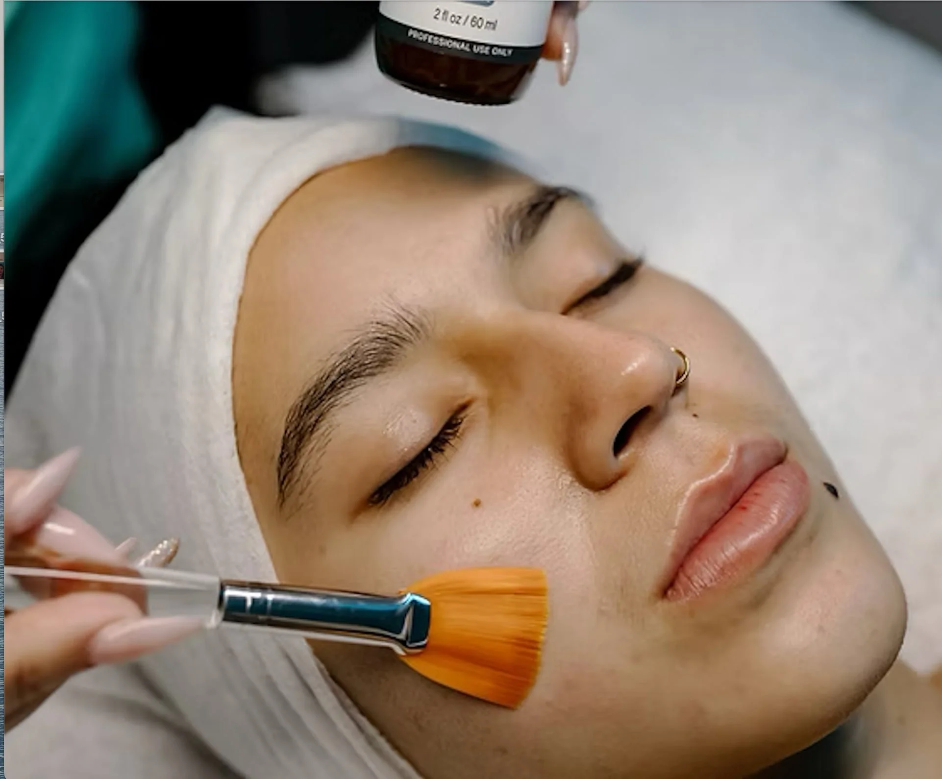 Dream-Facial-wentzville