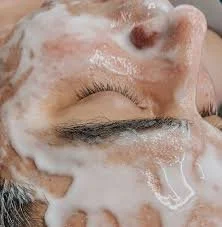 Oxygen-Facial-wentzville