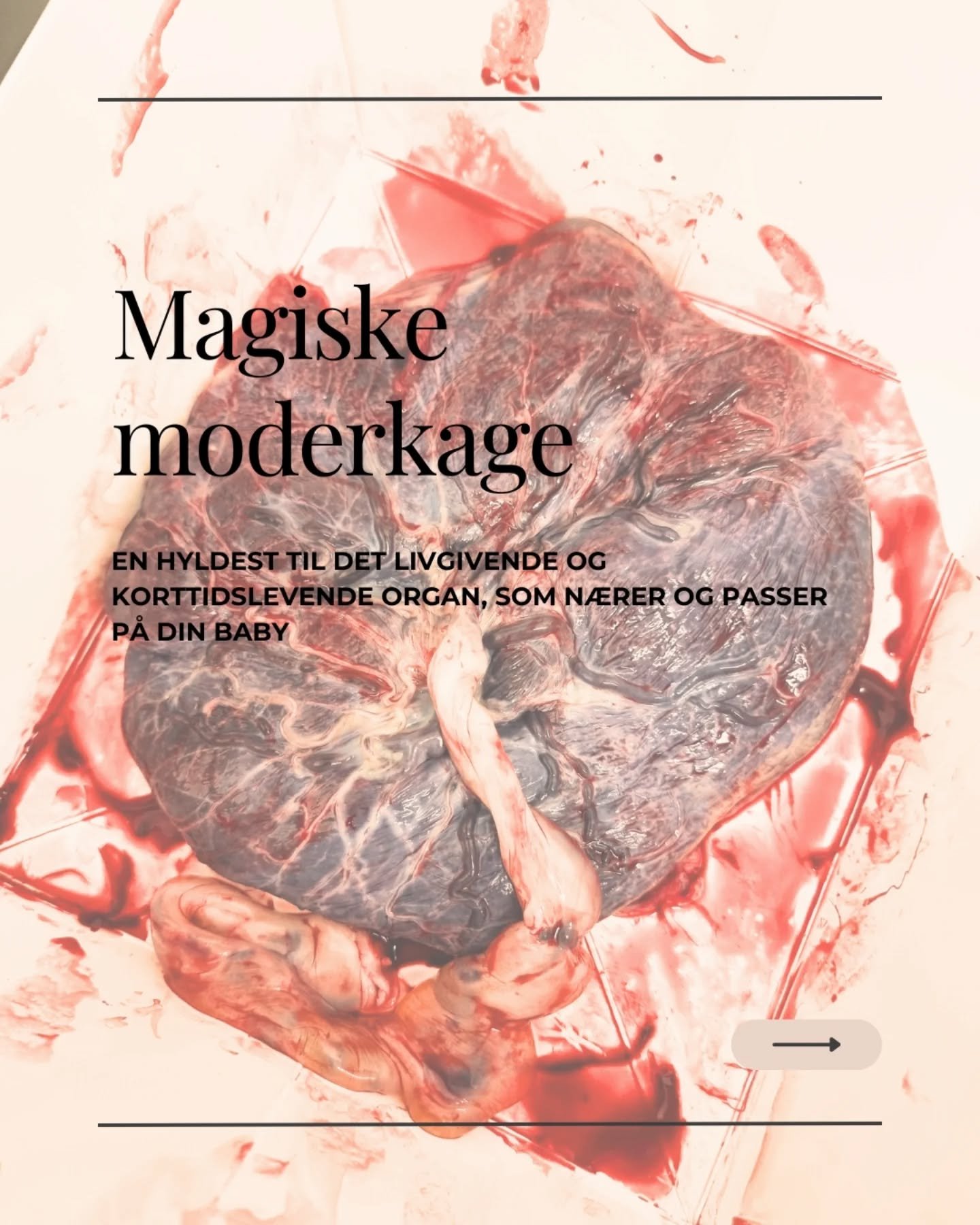✨ Magiske moderkage ✨
- En hyldest til det livgivende og kortidslevende organ, som n&aelig;rer og passer p&aring; din baby ❤️

L&aelig;s med, bliv klogere og m&aring;ske endda inspireret til, hvad der skal ske med jeres moderkage efter f&oslash;dslen