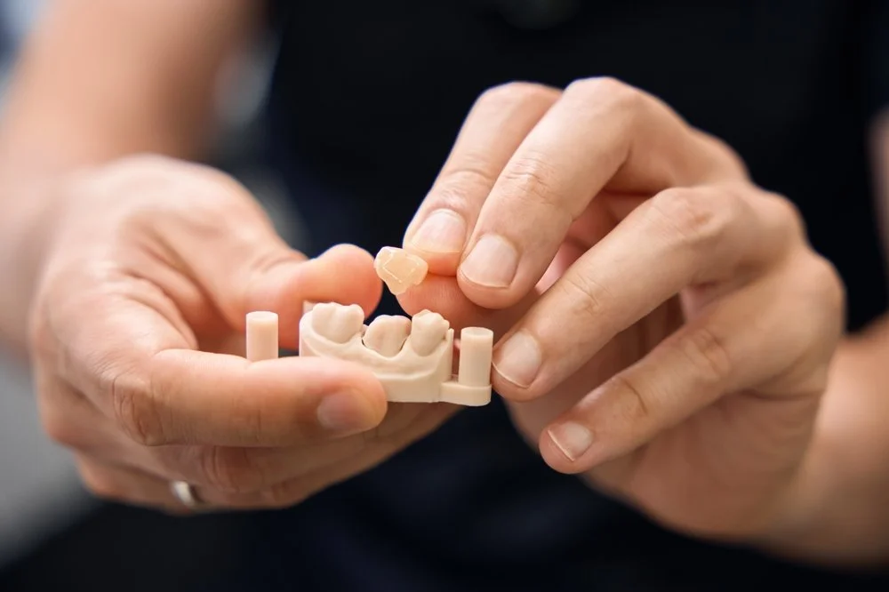 Dental Crowns: When Are They Needed and How Long Do They Last?