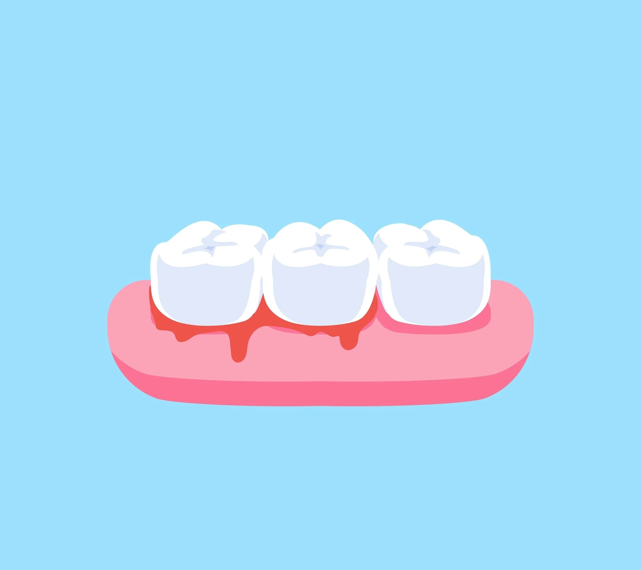 The Link Between Diabetes and Gum Disease — Rabalais Dental Centre