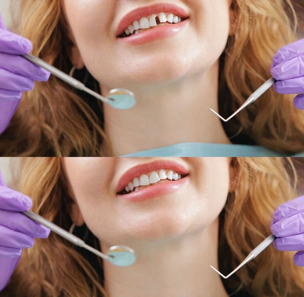 before and after cosmetic dentistry results showing improved smile and dental function