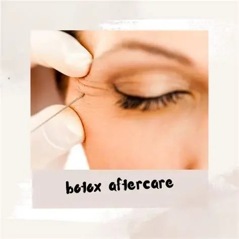 Botox Aftercare – The Complete Guide