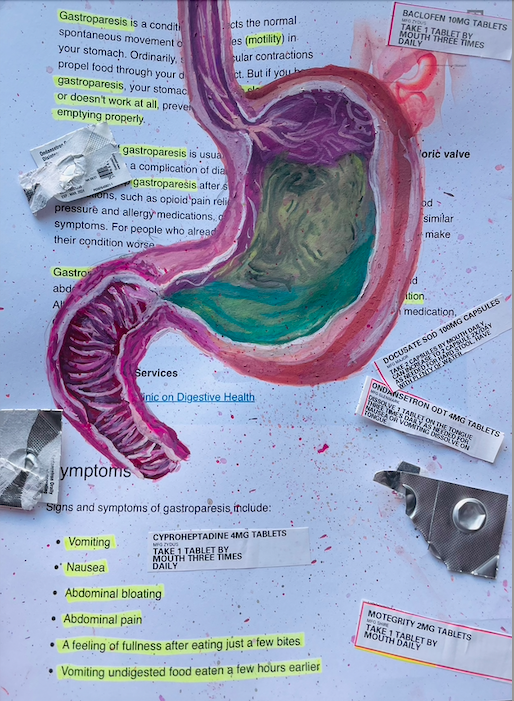 Neas_Gastroparesis_2024_8x11in.jpg