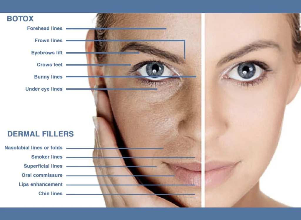 Botox and dermal fillers are popular injectable treatments used to reduce the appearance of wrinkles and improve facial aesthetics. 

While both treatments involve injections, they differ in their mechanism of action, duration of results, and suitabi