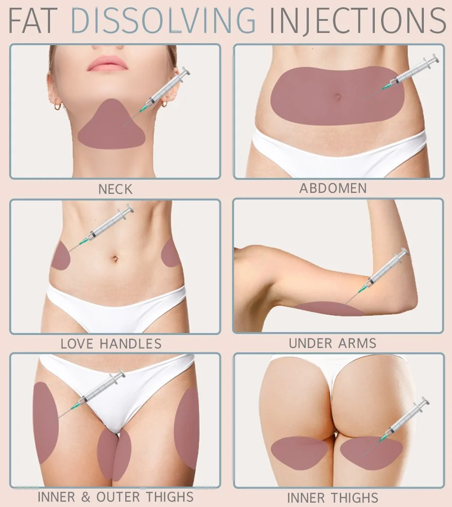 On this Weight Loss Wednesday we want to introduce you to &quot;Injection Lipolysis&quot;. 

Injection lipolysis is not a weight-loss treatment but rather a method to contour specific, localized fat deposits. 

It is a non-surgical cosmetic procedure