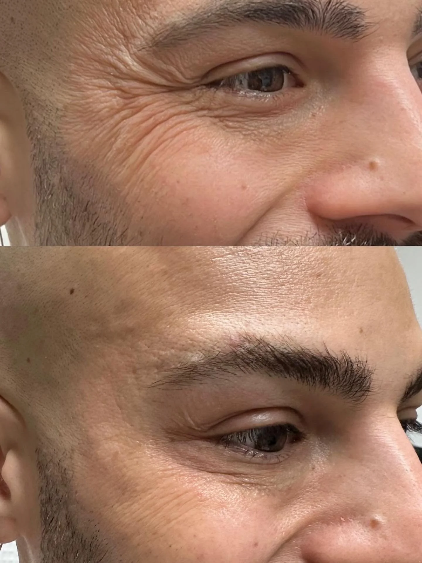 Botox isn&rsquo;t just for the girlies 

Men, it&rsquo;s time to step up your skincare game. A little Botox can smooth fine lines, keep you looking refreshed, and give that well-rested, confident look without anyone knowing why you look so good.

Rea