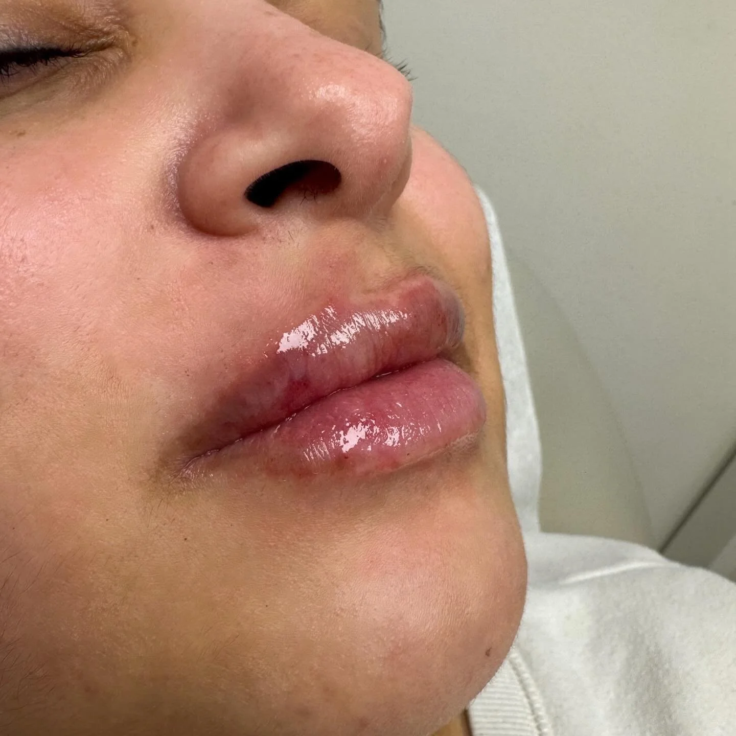Freshly plumped 💋