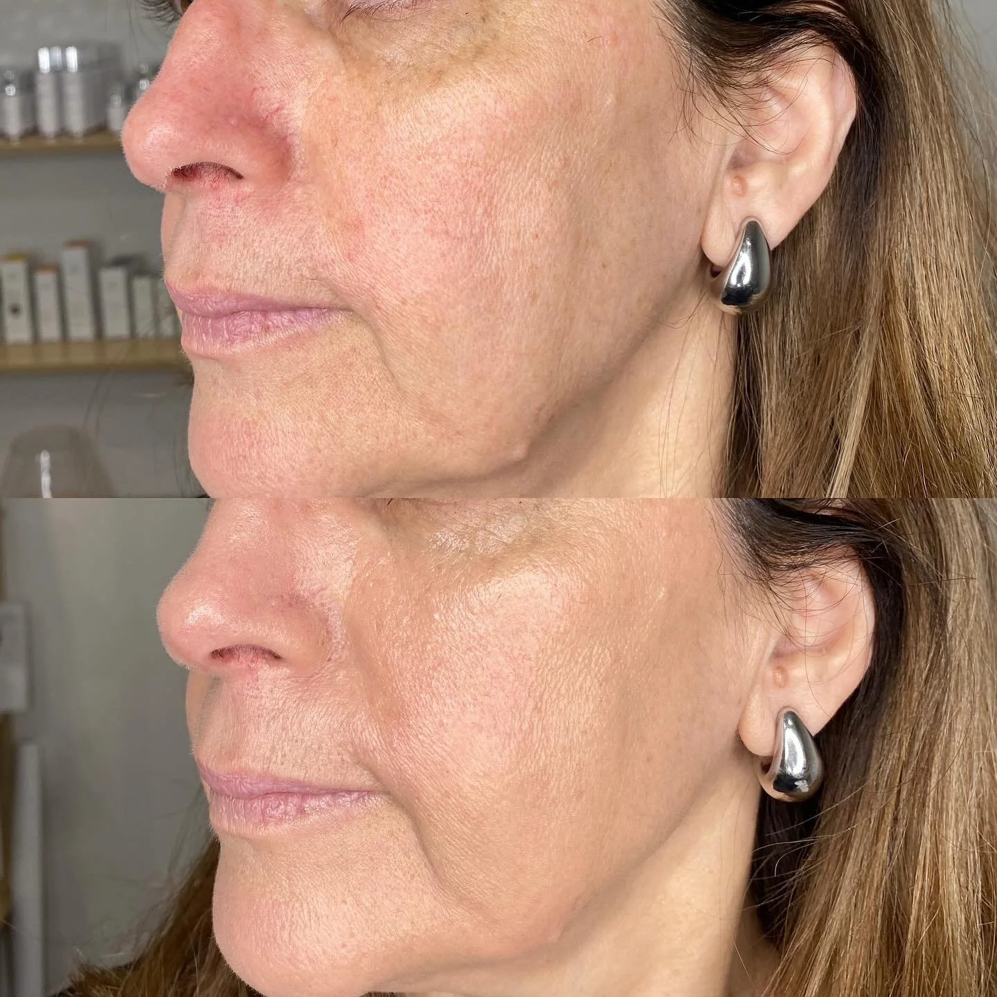 &bull;&bull;Tinted Dynamic Day Serum , spf30+ &bull;&bull;. 
@lefacecosmeceuticals. 
&bull;A healthy alternative to an everyday foundation, Moisturiser, treatment all in one with buildable Coverage. 
&bull;With Hyaluronic, Niacinamide, biomimetic pep