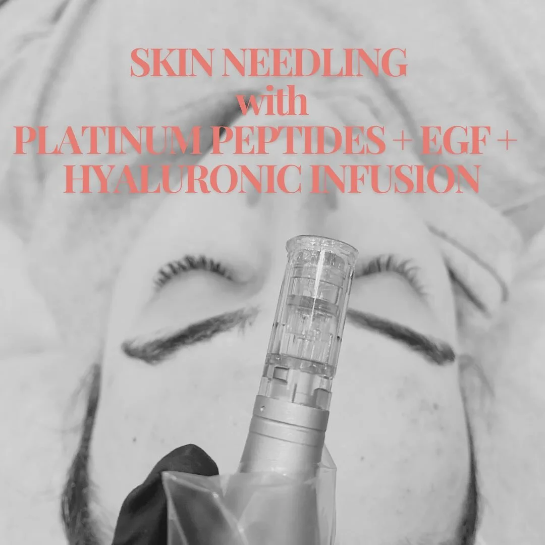 Advanced skin treatment we love 
&bull;Skin needling &bull;
This treatment includes an infusion of platinum Peptides + Epidermal Growth Factors(EGF) + Hyaluronic. This serum is needled into the skin for ultimate absorption, correction and regeneratio