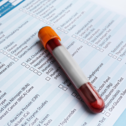 A blood sample in a test tube lying on a laboratory form or checklist.