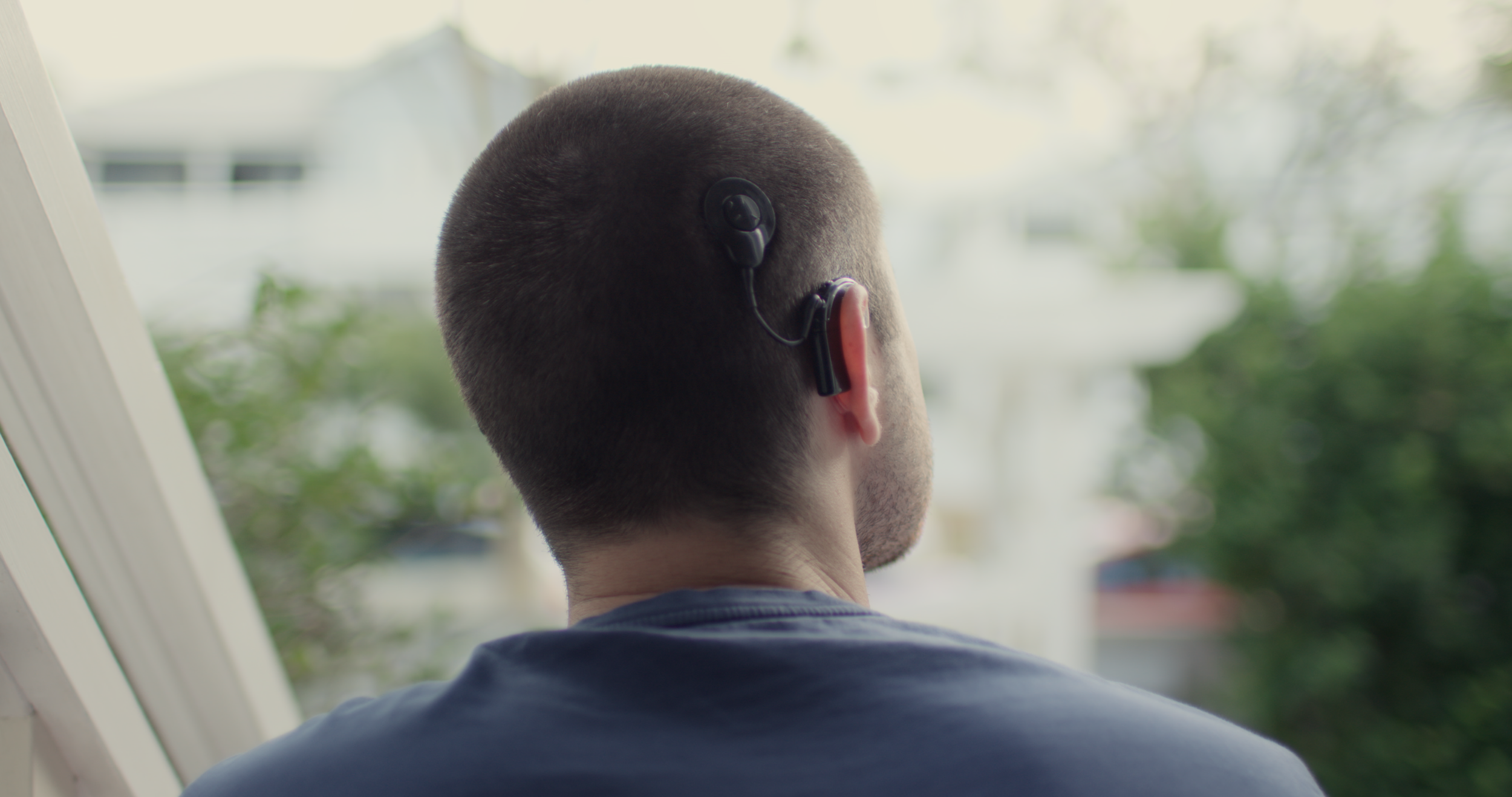 Life After Deaf - Angus McLeod