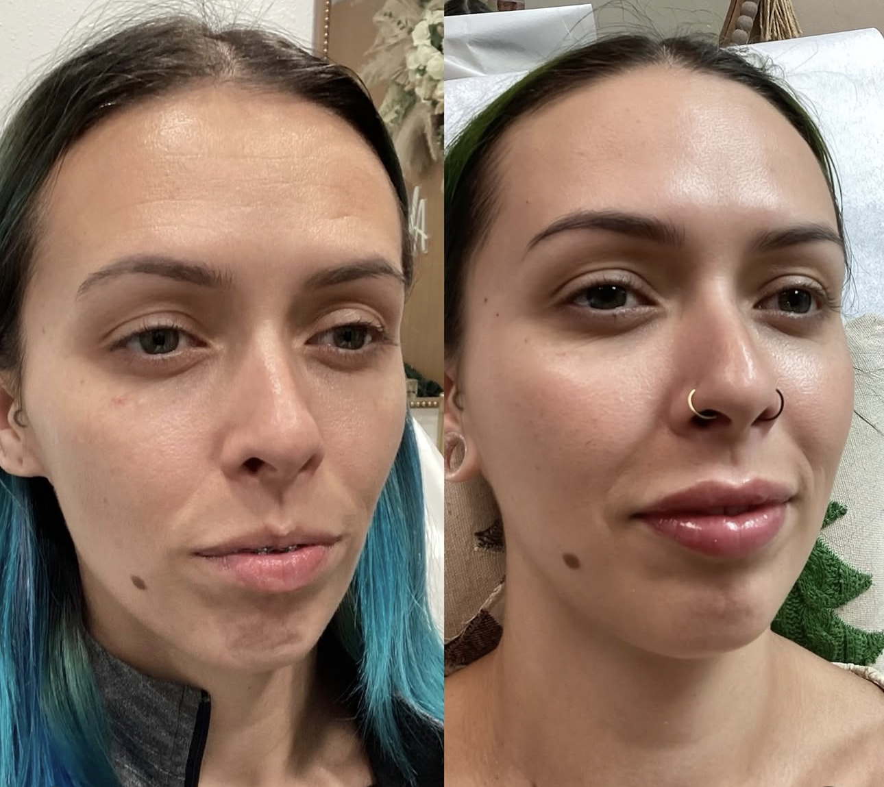 facial balance .png