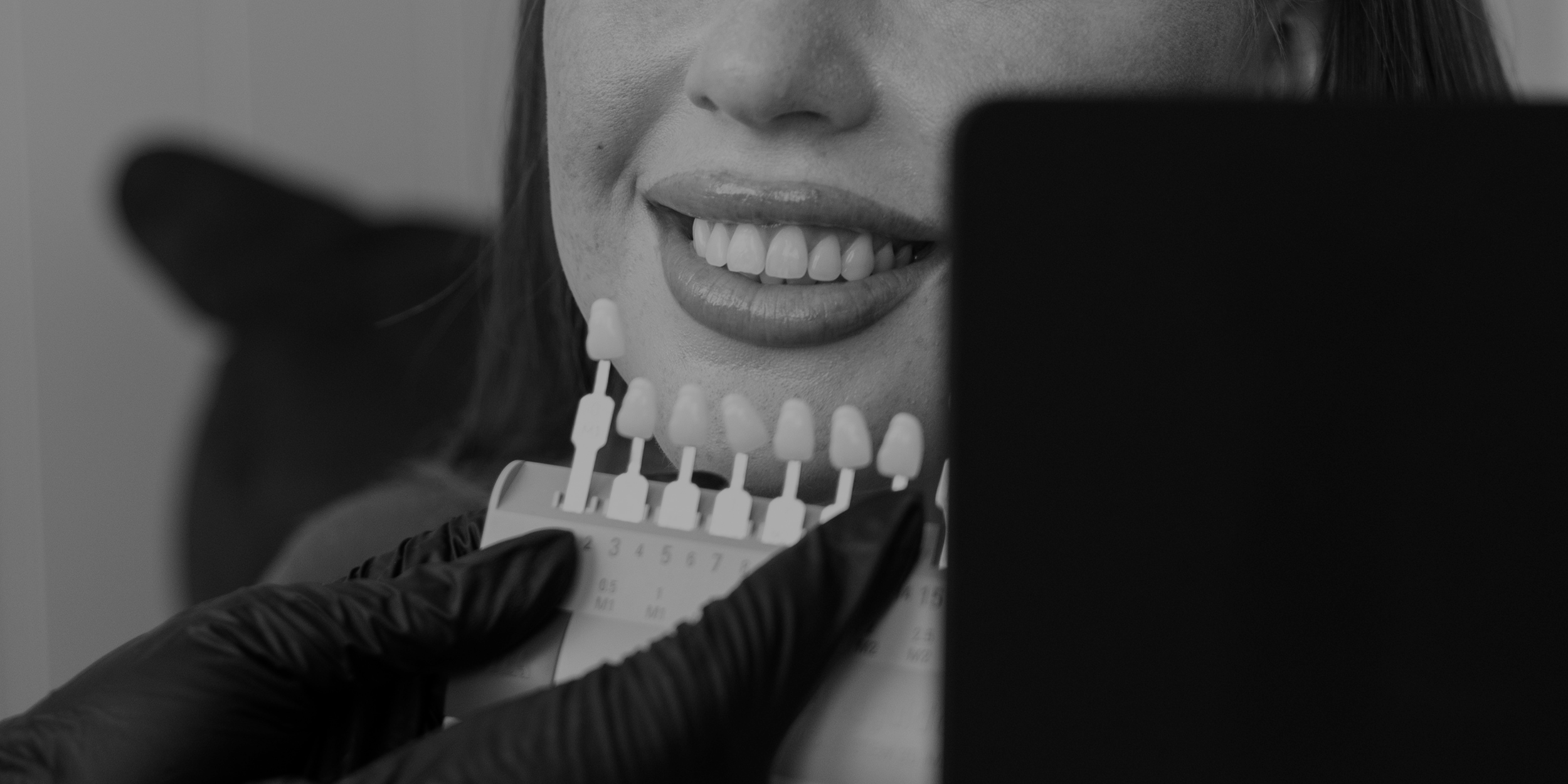 Auckland professional teeth whitening at home mobile Bronzed, comparing teeth whitening results